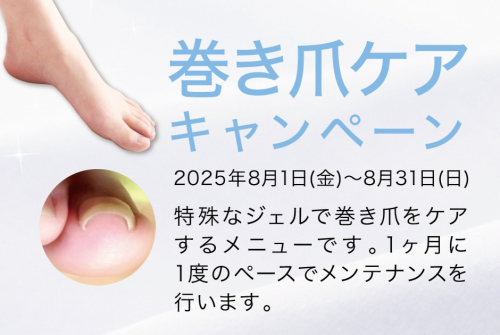 8月限定！巻き爪ケア初回キャンペーン実施中！
